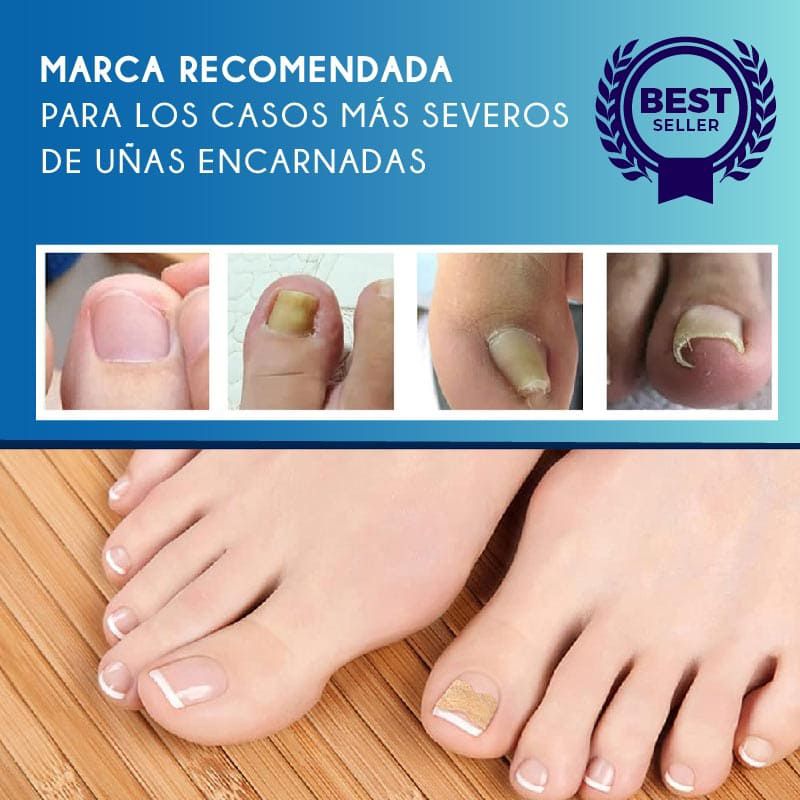 EasyPatch™ Parches Correctores De Uñas Uñeros (Pack X50 Und)